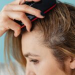 Fungal Infection on the Scalp: Causes, Symptoms, Treatments, and Real-Life Stories