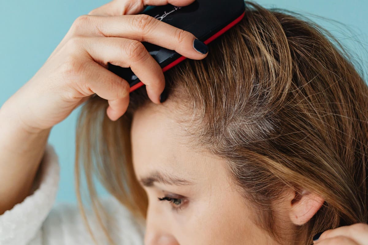 Fungal Scalp Infection: Causes, Symptoms & Best Treatments